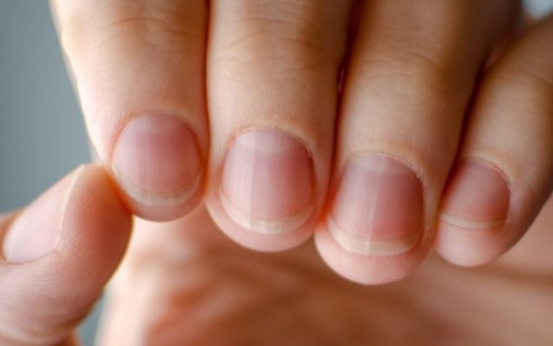 Τι μαρτυρούν τα νύχια για την υγεία μας!  - Media