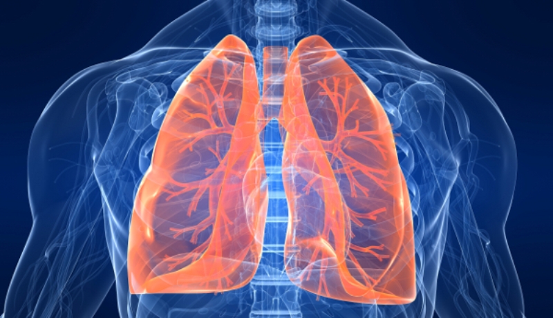 Καρκίνος του πνεύμονα: Ο κίνδυνος για όσους δεν καπνίζουν - Media