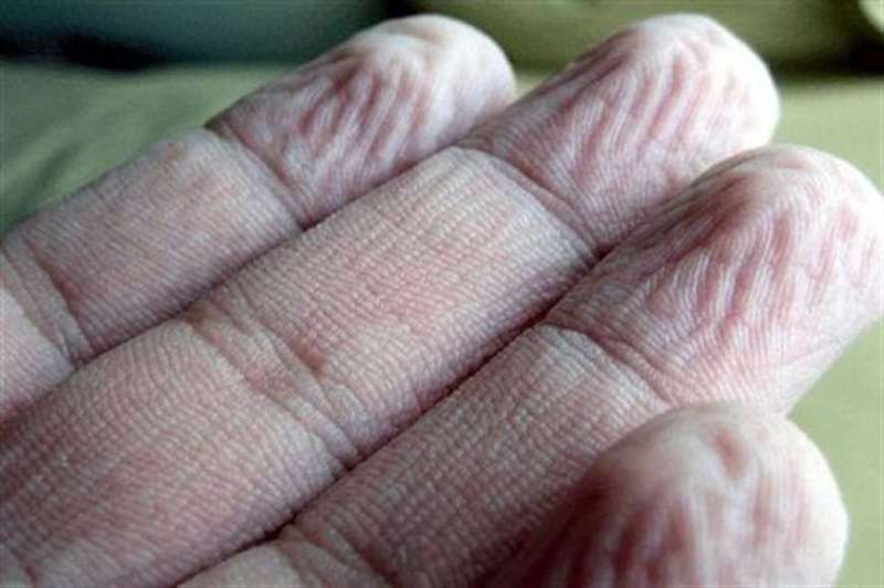 Γιατί το δέρμα στα δάχτυλά μας «ζαρώνει» όταν μένουν για ώρα στο νερό - Media