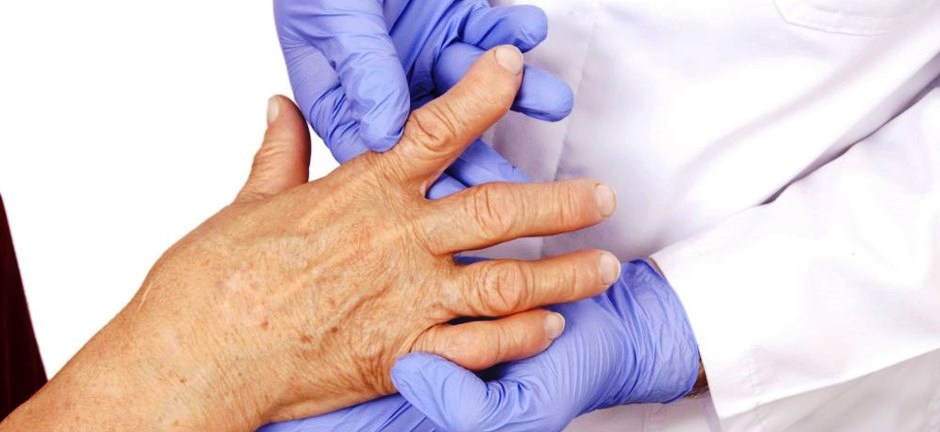 Η εμμηνόπαυση επιδεινώνει τη ρευματοειδή αρθρίτιδα - Media