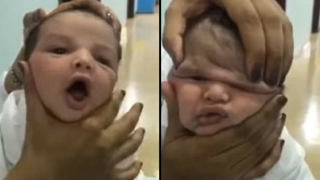 Τρεις νοσοκόμες κακοποιούσαν on camera άρρωστο βρέφος και γελούσαν (Video) - Media