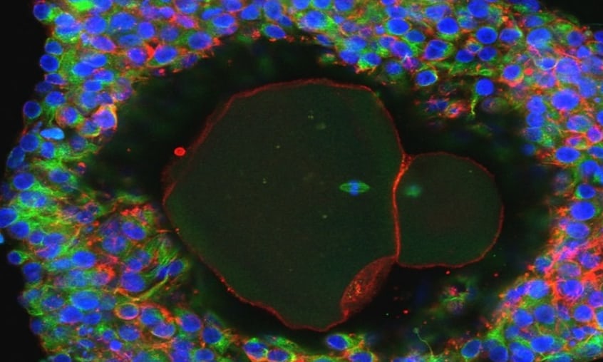 Ανθρώπινα ωάρια δημιουργήθηκαν στο εργαστήριο - Έρχονται νέες θεραπείες γονιμότητας - Media