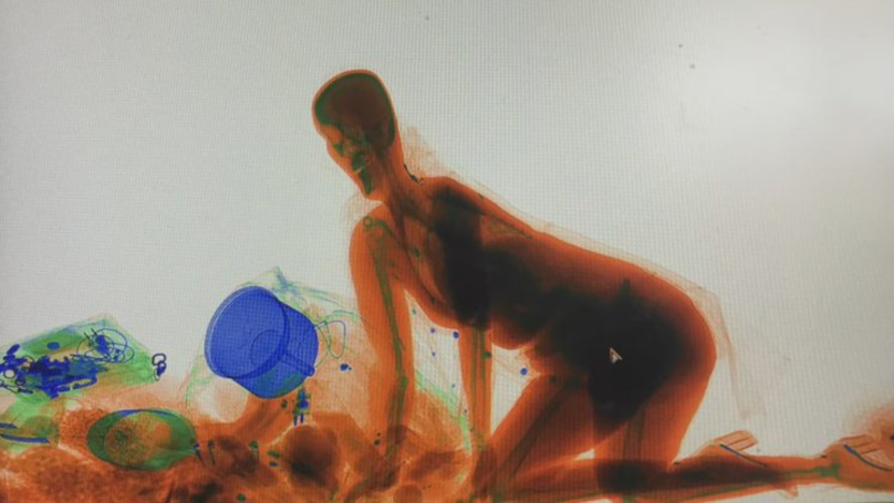 Μπήκε ολόκληρη στο σκάνερ αποσκευών γιατί δεν ήθελε να αφήσει την τσάντα της (Photo/Video) - Media