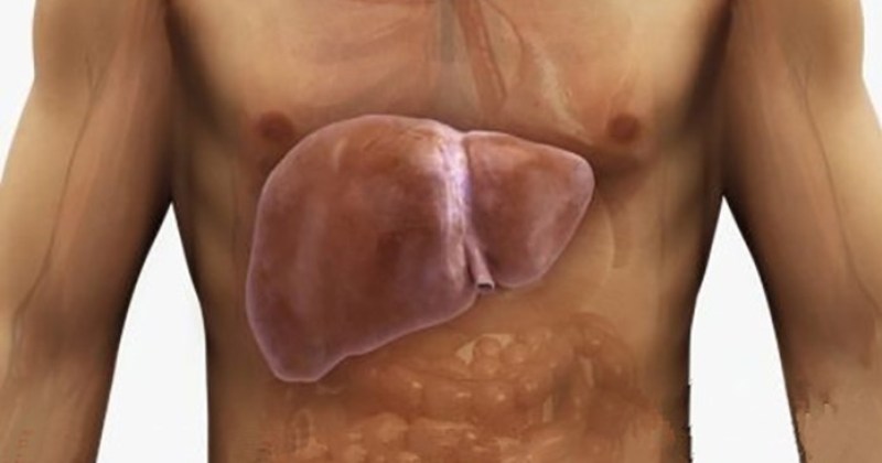 Λιπώδες ήπαρ: Η νέα «μάστιγα» του Δυτικού κόσμου – Προσοχή στα συμπτώματα - Media
