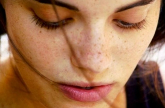 Πώς θα απαλλαχθείτε από τις πανάδες! - Media