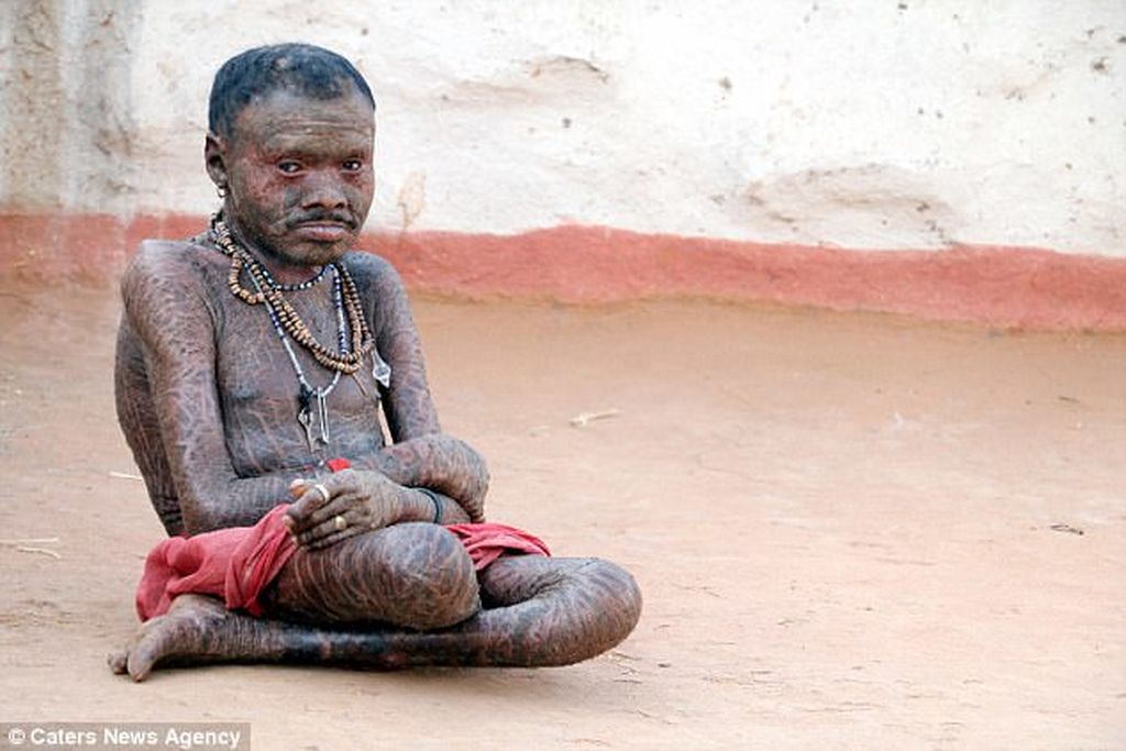 Ο άνθρωπος-φίδι της Ινδίας (Photos) - Media