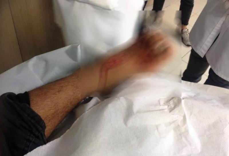 Πάτρα: «Λιμενικός μαχαίρωσε το προσφυγόπουλο» – Μήνυση από αλληλέγγυους (Σκληρές Photos) - Media