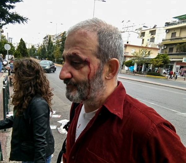 Χρυσαυγίτες επιτέθηκαν στην Αντιρατσιστική κίνηση ΚΕΕΡΦΑ (Photo)  - Media
