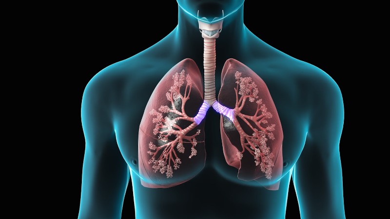 Καρκίνος του πνεύμονα: Τα επτά ύπουλα σημάδια που πιθανόν αγνοούμε - Media