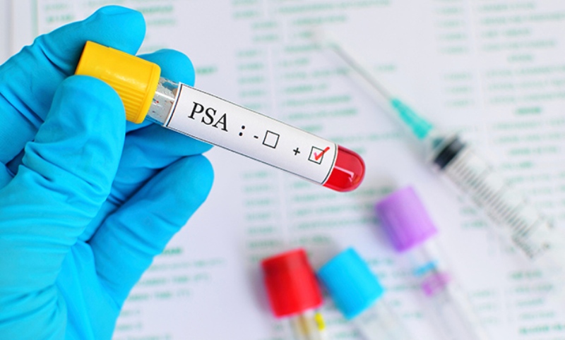 Καρκίνος προστάτη: Ακίνδυνη η θεραπεία υποκατάστασης με τεστοστερόνη - Media