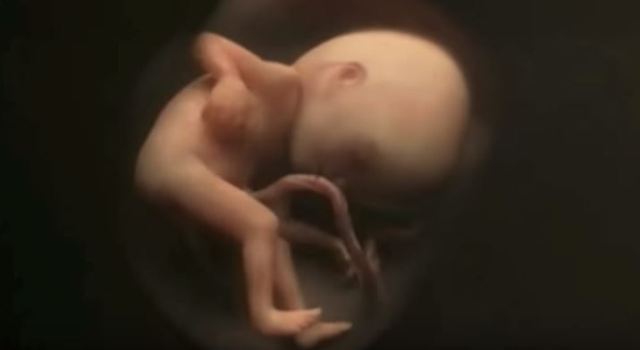 Πάτρα: Έμαθε ότι έχει καρκίνο στην εγκυμοσύνη της – Ήταν η τέταρτη προσπάθειά της να κάνει παιδί - Media