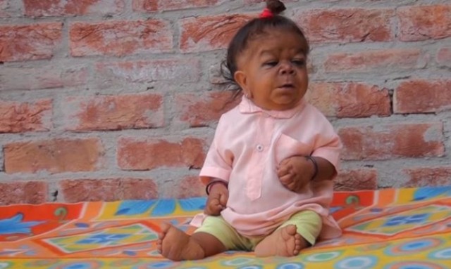 Είναι 23 χρόνων και ζει σε σώμα μικρού παιδιού! (Video) - Media