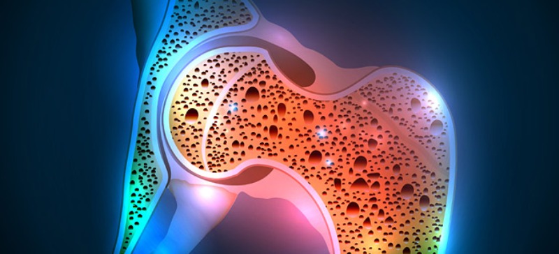 Έρευνα-σοκ: Ένας στους δύο Έλληνες πάσχει από οστεοπόρωση - Media