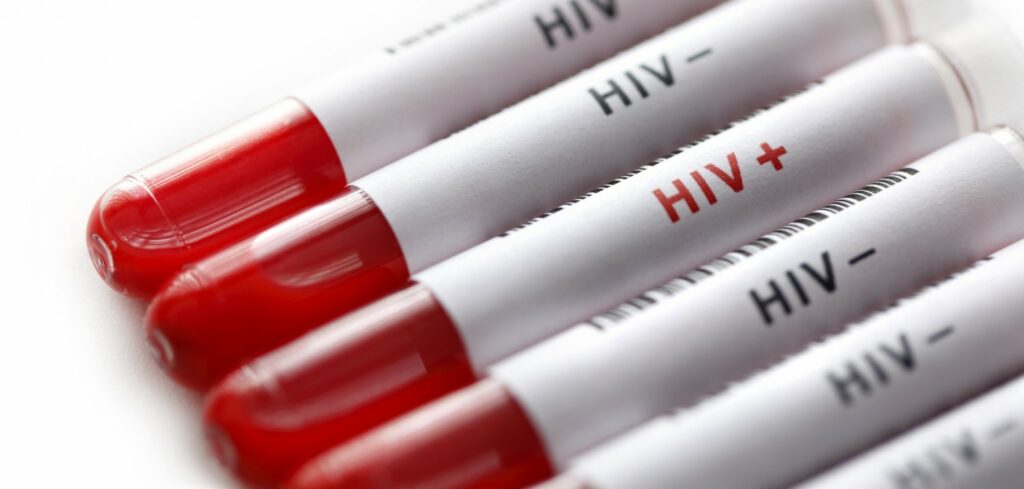 Σε ιδιωτικά εργαστήρια ο έλεγχοι για τον ιό HIV - Με διασφάλιση του απορρήτου - Media