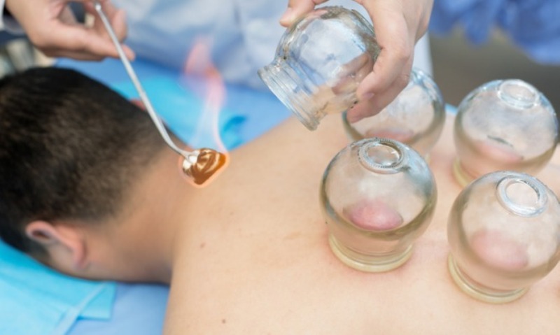 Βεντούζες με ποτήρια: Τι ισχύει πραγματικά για το παλιό γιατροσόφι - Media