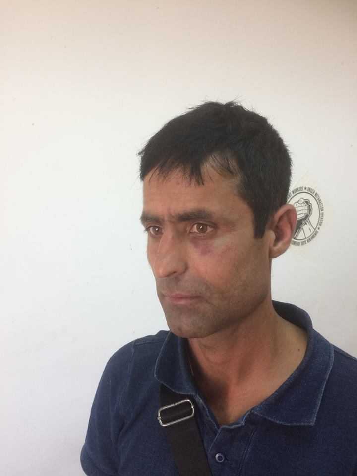 Ρατσιστική επίθεση κατά μετανάστη στο Περιστέρι - Τον έριξαν στο έδαφος και τον ξυλοκόπησαν - Media