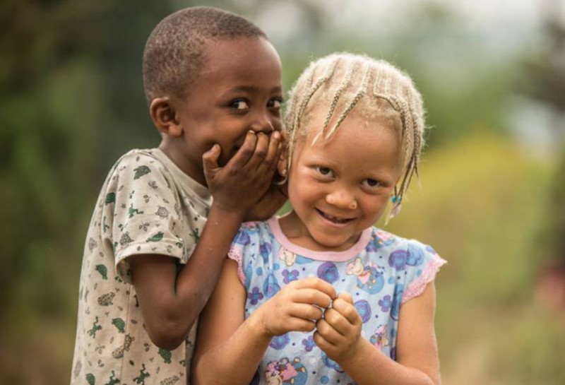 Φρίκη: Σκότωσαν πεντάχρονο κορίτσι αλμπίνο για να πάρουν τα «μαγικά» μέλη του - Media