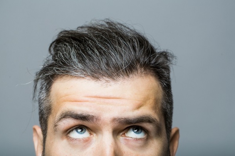 Γιατί ασπρίζουν τα μαλλιά; Περισσότερο φως στον ρόλο του ανοσοποιητικού - Media