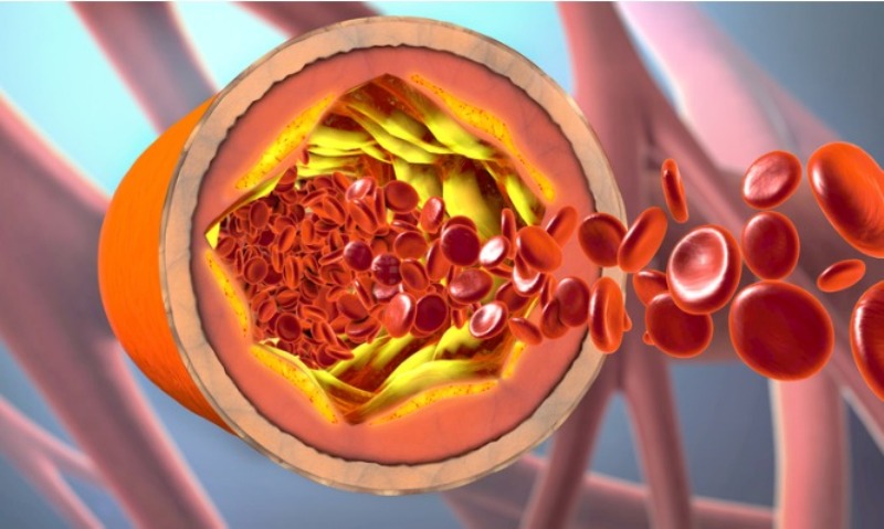 Τι είναι η χοληστερόλη και πώς την χρησιμοποιεί ο οργανισμός – Πότε υπάρχει πρόβλημα (Video) - Media