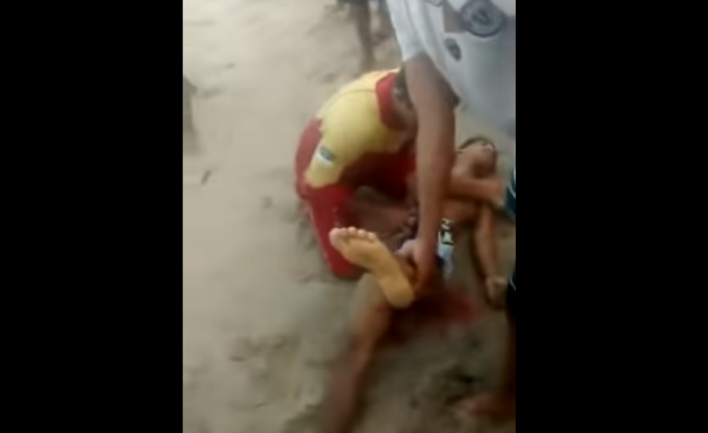 Καρχαρίας έκοψε το πέος άτυχου νεαρού λουόμενου (Σκληρό Video) - Media