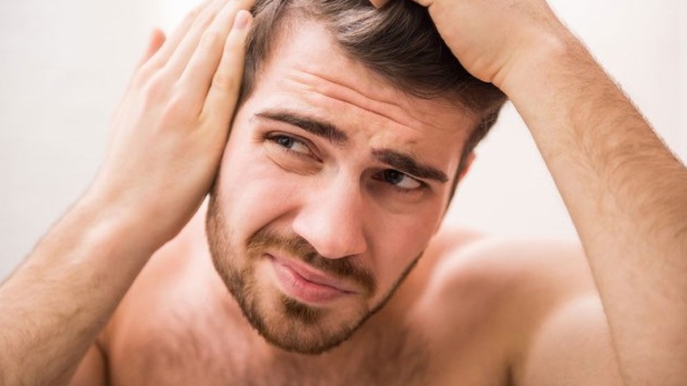 Τριχόπτωση: 16 λόγοι που κάνουν τα μαλλιά σας να πέφτουν - Media
