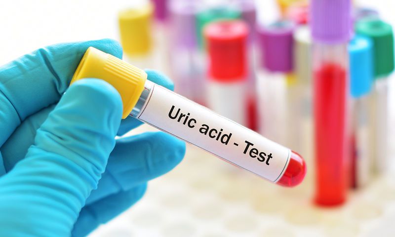 Ουρικό οξύ: Ποια τα κοινά συμπτώματα - Τι ρόλο παίζει η διατροφή  - Media