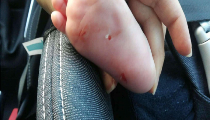 Στον εισαγγελέα οδηγείται η 55χρονη που φέρεται να χαράκωvε μωρά  - Media