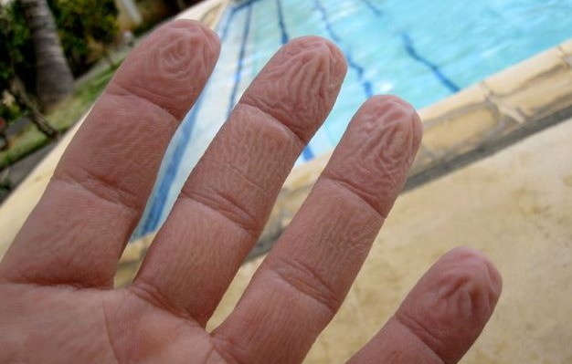 Για αυτό ζαρώνουν τα δάχτυλά μας μέσα στο νερό - Και δεν είναι επειδή «μούλιασαν» - Media