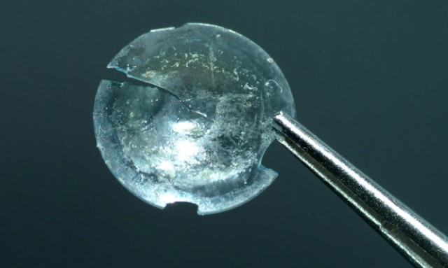 Κόλλησε φακός επαφής στο μάτι της και το κατάλαβε μετά από 28 χρόνια! (Video) - Media