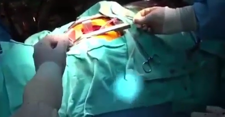 Σεισμός 7,1 Ρίχτερ κατά τη διάρκεια χειρουργικής επέμβασης καρδιάς (Σκληρές Εικόνες - Video) - Media