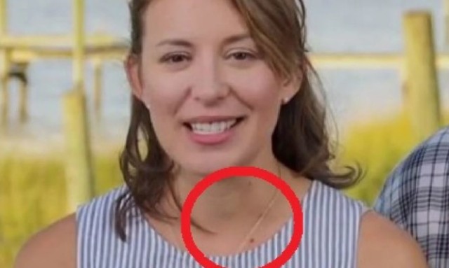 Γιατρός είδε αυτό σε γυναίκα που ήταν στην TV και την έσωσε από καρκίνο! (Video) - Media