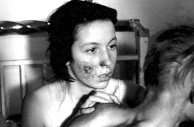 Η ερωτική σκηνή μεταξύ δύο λεπρών που προκάλεσε σάλο στην πρώτη ταινία για τη Σπιναλόγκα - Media