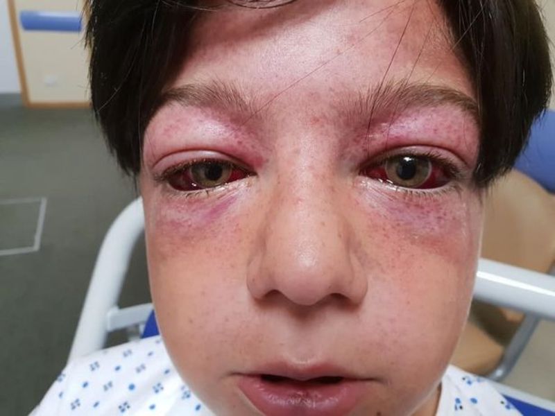 Θρίλερ σε παιδική χαρά: Σοβαρά τραυματισμένο 11χρονο αγόρι για βίντεο στο Youtube - Ο τροχός μηχανής και ο περιστρεφόμενος μύλος (Σκληρές Photos) - Media