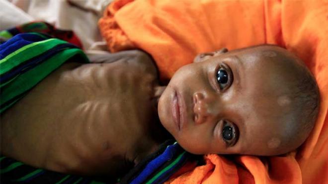 Δραματική προειδοποίηση του ΟΗΕ - Χάνουμε τη μάχη με το λιμό στην Υεμένη - Media