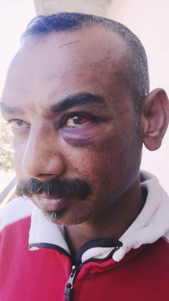 Νέα ρατσιστική επίθεση στον Ασπρόπυργο - Φασιστοειδή χτύπησαν Πακιστανό εργάτη με σιδηρογροθιά - Media