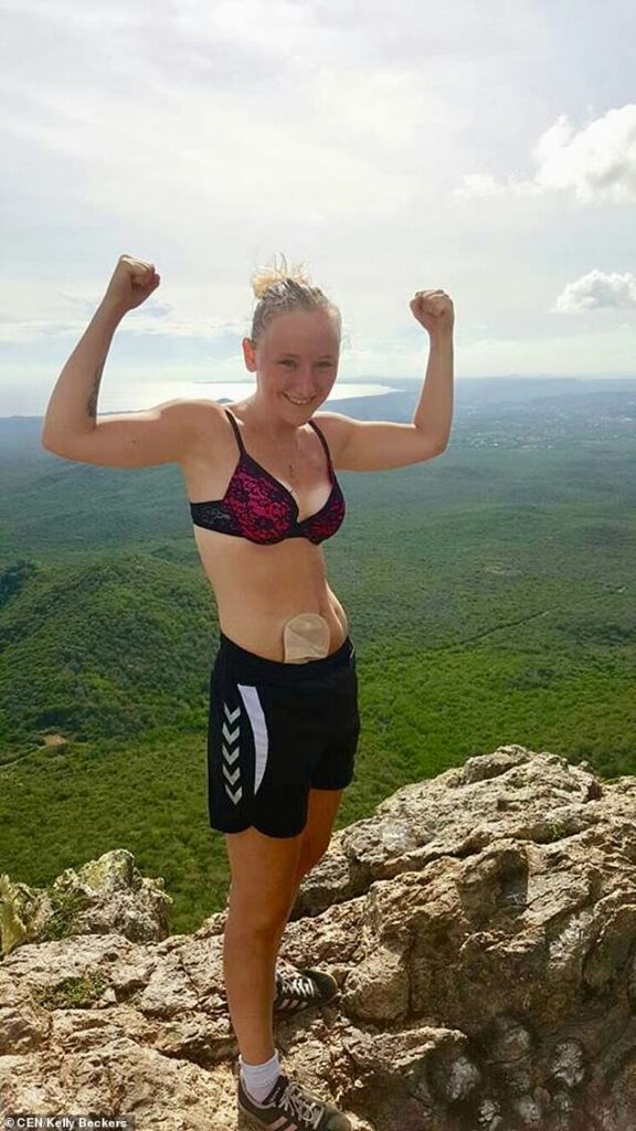 Έχει τέσσερα χρόνια να φάει, κι όμως ζει και βασιλεύει (photos) - Media