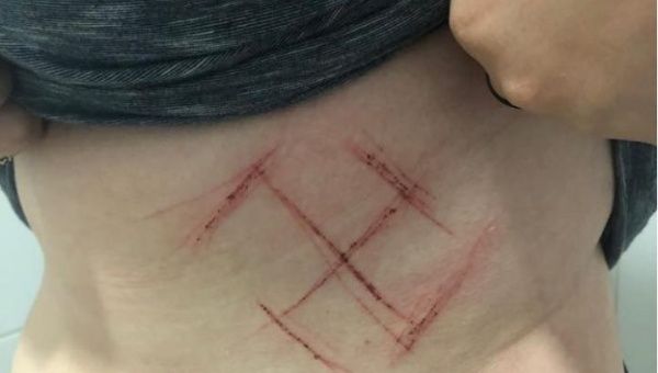 Η παρέλαση του παλιού-καινούργιου: Οπαδοί του Μπολσονάρο χάραξαν μία σβάστικα στην κοιλιά 19χρονης κοπέλας (Pic) - Media