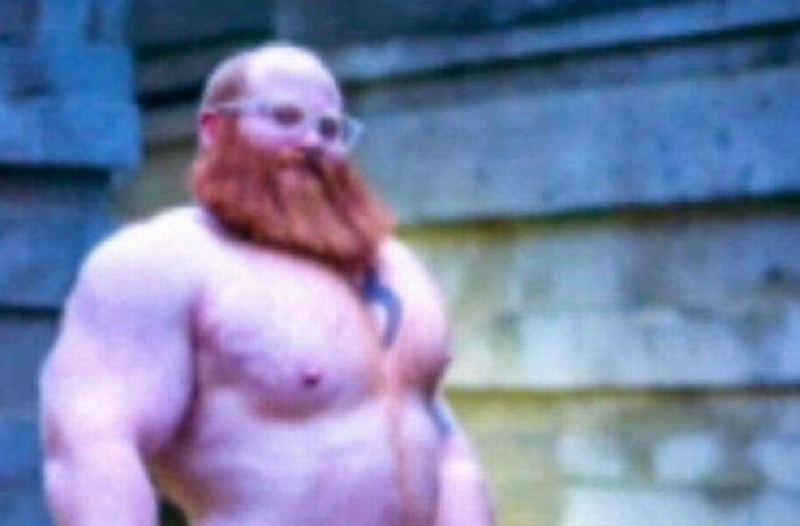 Έβαλε σιλικόνη στα… γεννητικά του όργανα και πέθανε (Photos) - Media