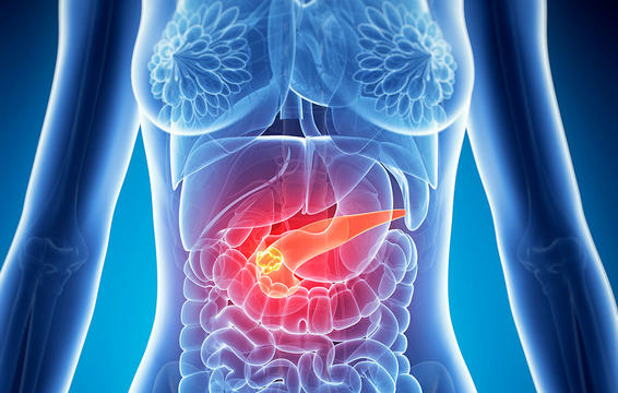 Καρκίνος στο πάγκρεας: Ποιος ο ρόλος των κιλών στην εφηβεία; - Media