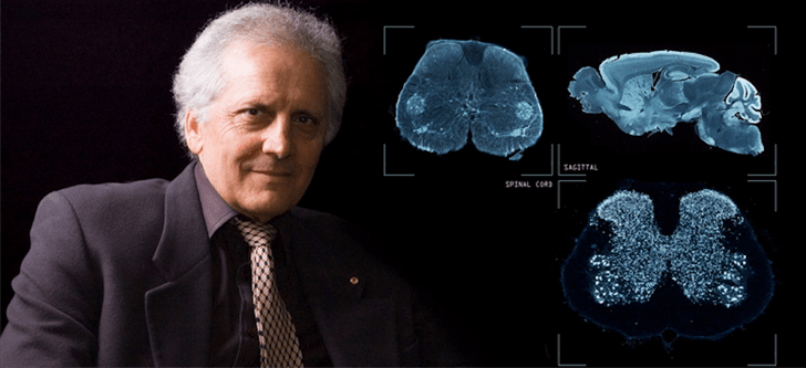 Έλληνας της διασποράς ανακάλυψε αχαρτογράφητη περιοχή στον ανθρώπινο εγκέφαλο - Media