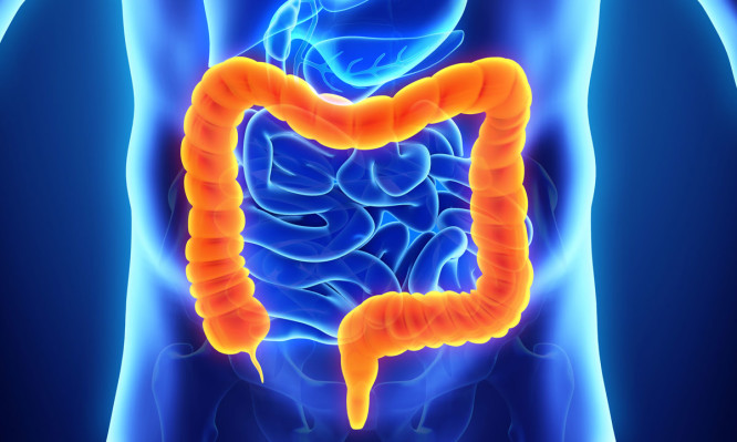 Καρκίνος παχέος εντέρου: Με αυτά τα συμπτώματα ξεκινά (Video) - Media