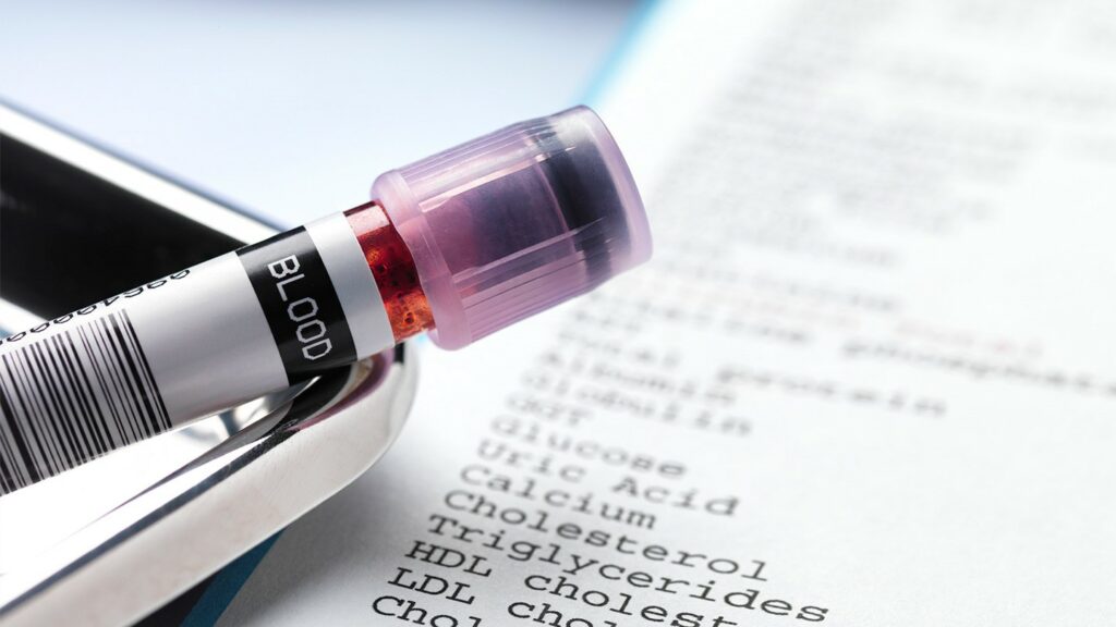 Χοληστερίνη και τριγλυκερίδια: Ποια είναι τα όρια – Υπολογισμός - Media