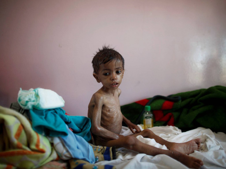 Η Υεμένη λιμοκτονεί, ο πλανήτης κωφεύει - Νέα έκκληση του ΟΗΕ - Media