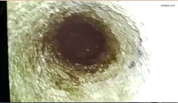 Ισπανία: Πέντε μέρες εγκλωβισμένο σε πηγάδι αγοράκι – Σκάβουν σήραγγα για να το βγάλουν (Photos) - Media