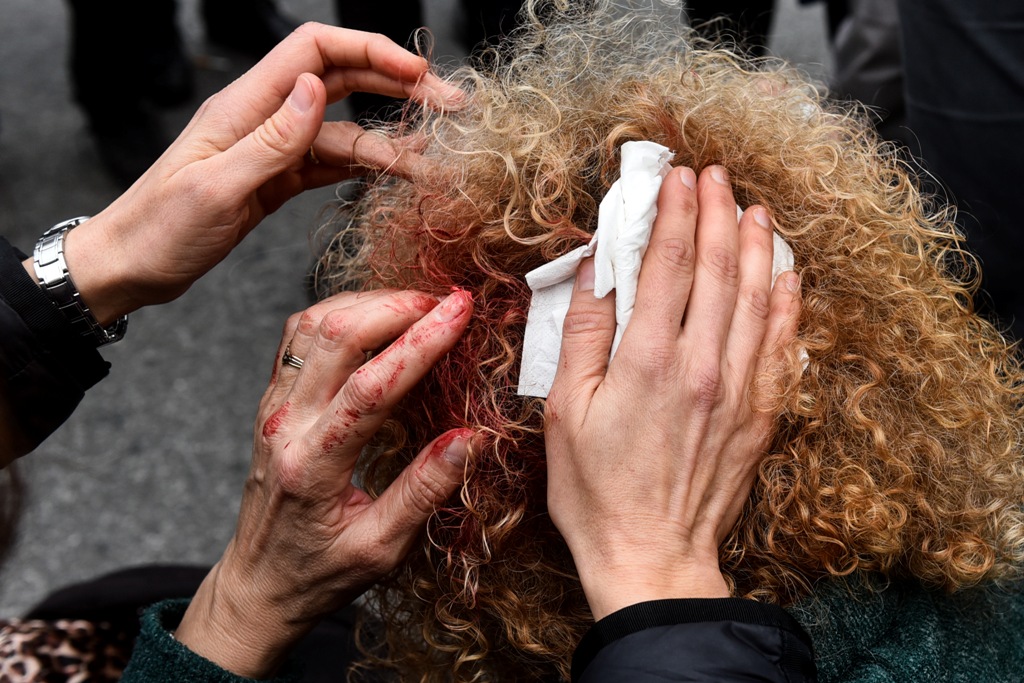 Η Όλγα Γεροβασίλη καταδικάζει τον τραυματισμό εκπαιδευτικού από τα ΜΑΤ - Διατάχτηκε ΕΔΕ - Media