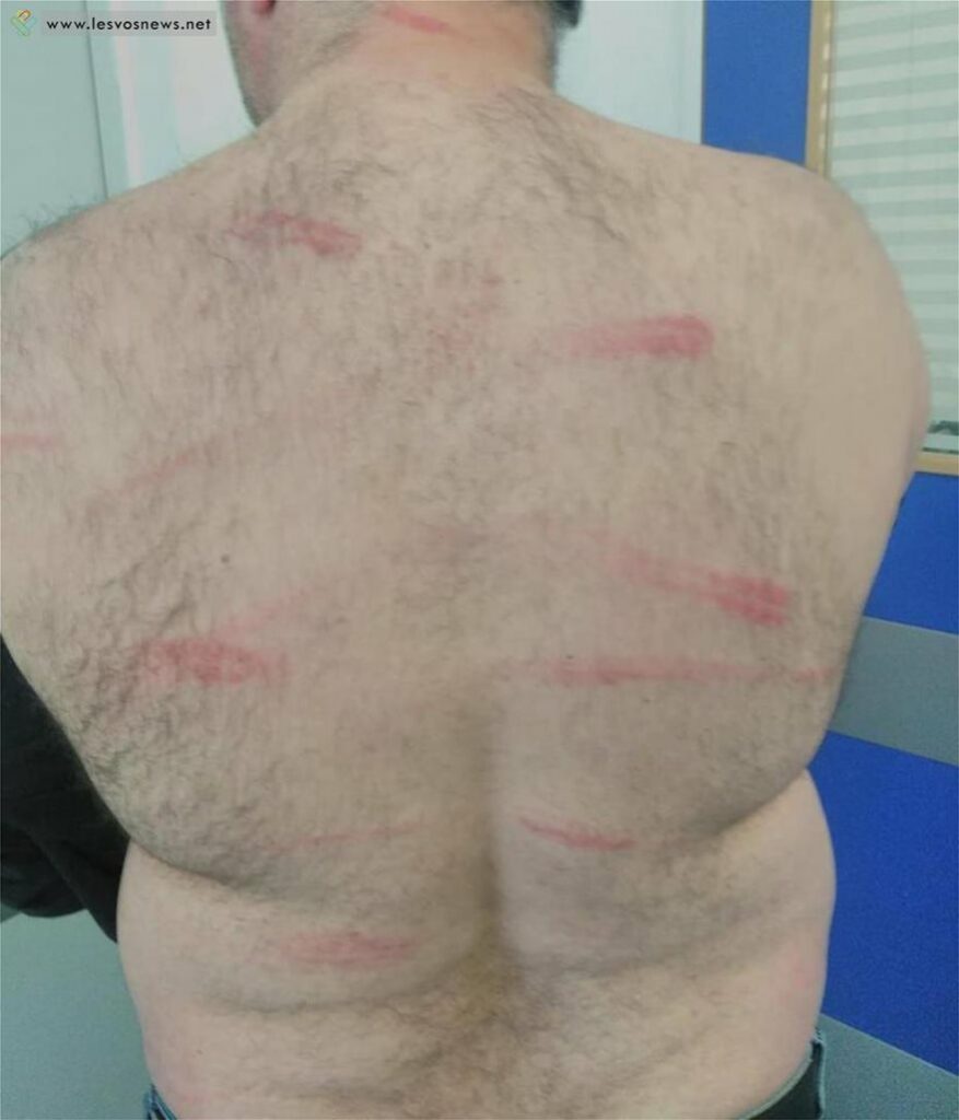 Λέσβος: Αγριο ξύλο σε καφενείο μετά τη… βασιλόπιτα    - Media