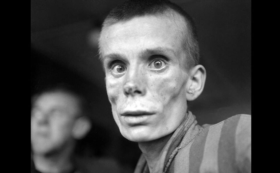 Αυτός είναι ο ναζισμός – Σκληρές φωτογραφίες από τις θηριωδίες των ναζί στα στρατόπεδα εξόντωσης (Photos) - Media
