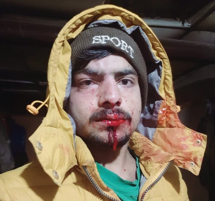 Λάρισα: Πακιστανοί ζήτησαν δεδουλευμένα από κτηνοτρόφο - Τους έδειρε μαζί με μπράβους - Media