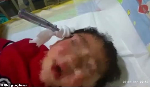 Σφήνωσε κατσαβίδι στο κεφάλι αγοριού τριών ετών (Σκληρές Photos) - Media