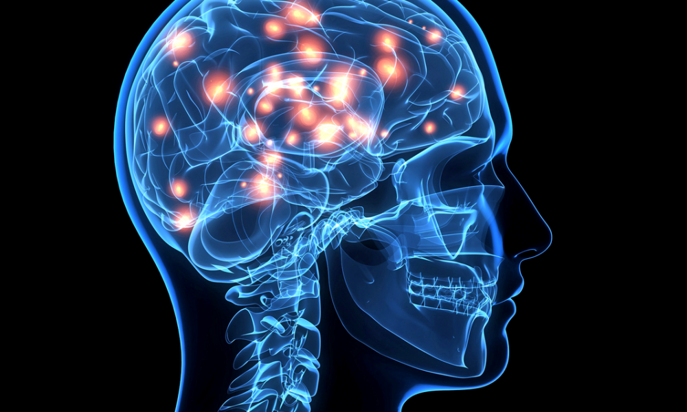 Αγγειακή άνοια: Τα συχνά και «ύπουλα» συμπτώματα  - Media